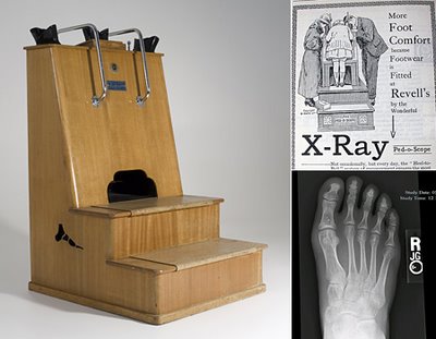 X-ray shoe-fitting machine