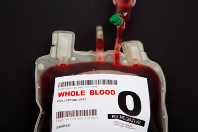 istockphoto. Color photograph showing a whole blood collection bag.